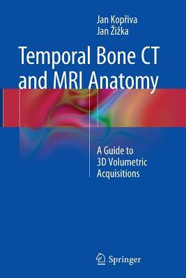 Read Temporal Bone CT and MRI Anatomy: A Guide to 3D Volumetric Acquisitions - Jan Kopřiva file in PDF