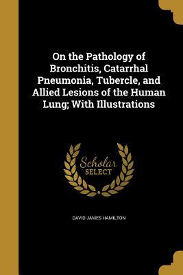 Read online On the Pathology of Bronchitis, Catarrhal Pneumonia, Tubercle, and Allied Lesions of the Human Lung; With Illustrations - David James Hamilton file in ePub